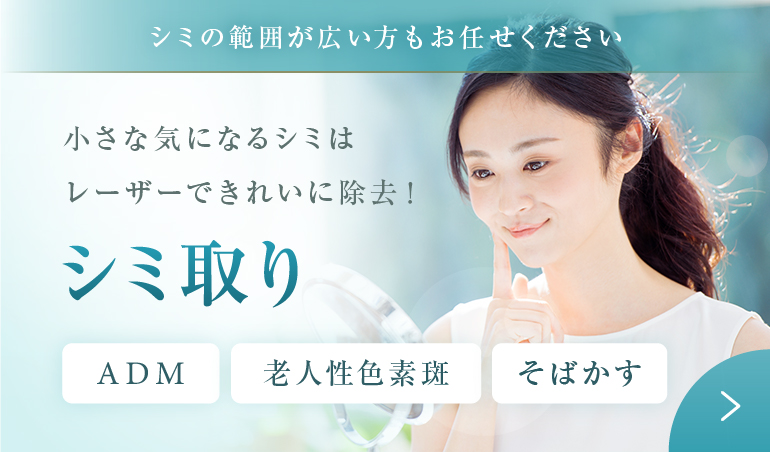 シミ取り